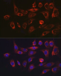 Invitrogen SERPINH1 Polyclonal Antibody 100 &mu;L; Unconjugated:Antibodies,