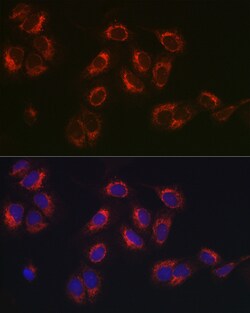 Invitrogen SERPINH1 Polyclonal Antibody 100 &mu;L; Unconjugated:Antibodies,