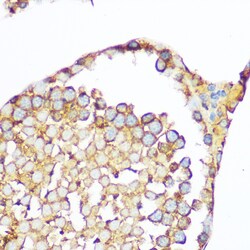 Invitrogen SERPINH1 Polyclonal Antibody 100 &mu;L; Unconjugated:Antibodies,