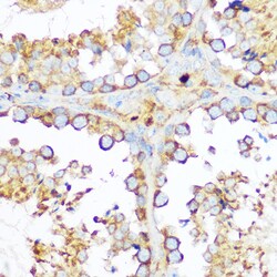 Invitrogen SERPINH1 Polyclonal Antibody 100 &mu;L; Unconjugated:Antibodies,