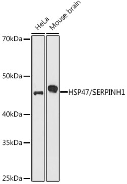 Invitrogen SERPINH1 Polyclonal Antibody 100 &mu;L; Unconjugated:Antibodies,