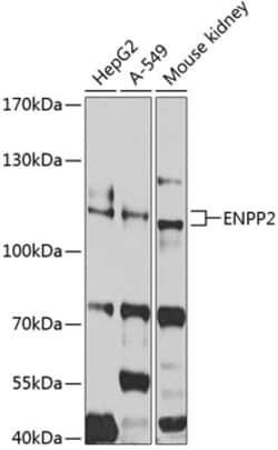 Invitrogen ENPP2 Polyclonal Antibody 100 &mu;L; Unconjugated:Antibodies,