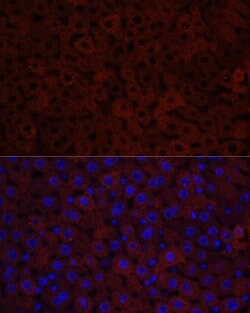 CYP3A4 Polyclonal Antibody, Invitrogen 100 &mu;L; Unconjugated:Antibodies,