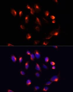 CYP3A4 Polyclonal Antibody, Invitrogen 100 &mu;L; Unconjugated:Antibodies,