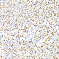 CYP3A4 Polyclonal Antibody, Invitrogen 100 &mu;L; Unconjugated:Antibodies,