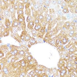CYP3A4 Polyclonal Antibody, Invitrogen 100 &mu;L; Unconjugated:Antibodies,