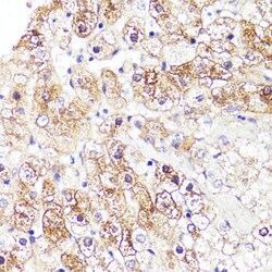 CYP3A4 Polyclonal Antibody, Invitrogen 100 &mu;L; Unconjugated:Antibodies,