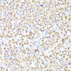 CYP3A4 Polyclonal Antibody, Invitrogen 100 &mu;L; Unconjugated:Antibodies,
