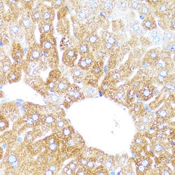 CYP3A4 Polyclonal Antibody, Invitrogen 100 &mu;L; Unconjugated:Antibodies,