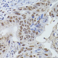 Invitrogen MRE11 Polyclonal Antibody 100 &mu;L; Unconjugated:Antibodies,