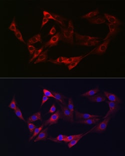 Invitrogen Neuropilin 2 Polyclonal Antibody 100 &mu;L; Unconjugated:Antibodies,