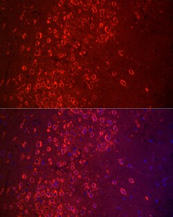 Invitrogen APLP1 Polyclonal Antibody 100 &mu;L; Unconjugated:Antibodies,