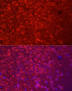 Invitrogen APLP1 Polyclonal Antibody 100 &mu;L; Unconjugated:Antibodies,