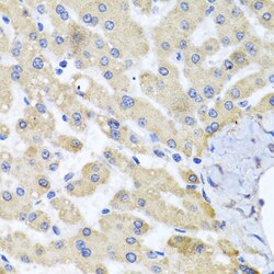 Invitrogen ABCB8 Polyclonal Antibody 100 &mu;L; Unconjugated:Antibodies,