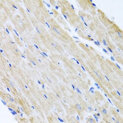 Invitrogen ABCB8 Polyclonal Antibody 100 &mu;L; Unconjugated:Antibodies,