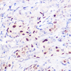 Invitrogen p21 Polyclonal Antibody 100 &mu;L; Unconjugated:Antibodies,