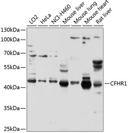 Invitrogen CFHR1 Polyclonal Antibody 100 &mu;L; Unconjugated:Antibodies,