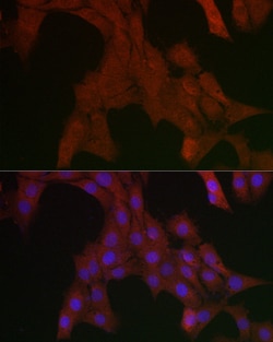Invitrogen SHP2 Polyclonal Antibody 100 &mu;L; Unconjugated:Antibodies,