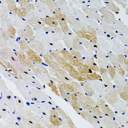 Invitrogen SHP2 Polyclonal Antibody 100 &mu;L; Unconjugated:Antibodies,