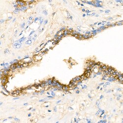 Invitrogen SERPINA3 Polyclonal Antibody 100 &mu;L; Unconjugated:Antibodies,