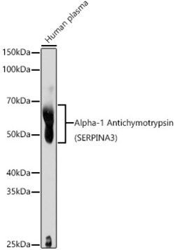 Invitrogen SERPINA3 Polyclonal Antibody 100 &mu;L; Unconjugated:Antibodies,