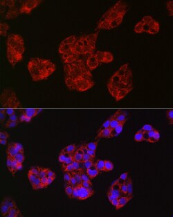 Invitrogen Leptin Receptor Polyclonal Antibody 100 &mu;L; Unconjugated:Antibodies,