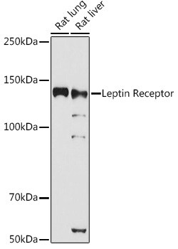 Invitrogen Leptin Receptor Polyclonal Antibody 100 &mu;L; Unconjugated:Antibodies,
