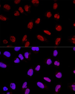 Invitrogen AKAP8 Polyclonal Antibody 100 μL; Unconjugated:Antibodies,