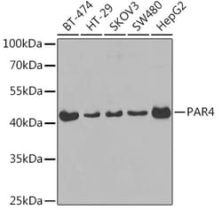 Invitrogen PAR4 Polyclonal Antibody 100 &mu;L; Unconjugated:Antibodies,