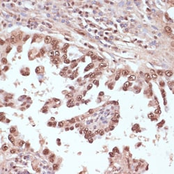 Invitrogen RAD50 Polyclonal Antibody 100 &mu;L; Unconjugated:Antibodies,
