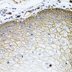 SLC1A4 Polyclonal Antibody, Invitrogen 100 &mu;L; Unconjugated:Antibodies,