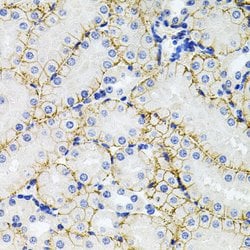SLC1A4 Polyclonal Antibody, Invitrogen 100 &mu;L; Unconjugated:Antibodies,