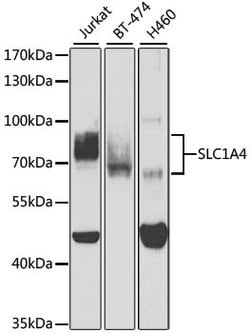SLC1A4 Polyclonal Antibody, Invitrogen 100 &mu;L; Unconjugated:Antibodies,