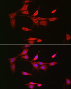 Invitrogen NOTCH3 Polyclonal Antibody 100 μL; Unconjugated:Antibodies,