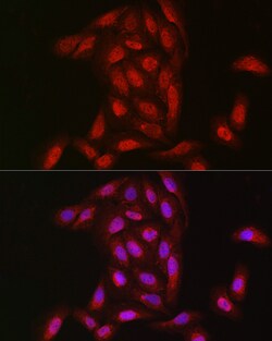 Invitrogen NOTCH3 Polyclonal Antibody 100 μL; Unconjugated:Antibodies,