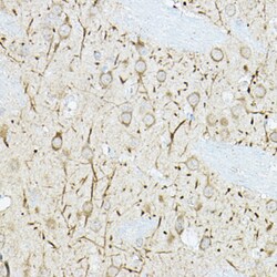 Invitrogen MKP3 Polyclonal Antibody 100 &mu;L; Unconjugated:Antibodies,