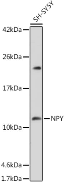 Invitrogen NPY Polyclonal Antibody 100 &mu;L | Buy Online | Invitrogen&trade; | Fisher Scientific