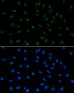 Invitrogen MNAR Polyclonal Antibody 100 &mu;L; Unconjugated:Antibodies,