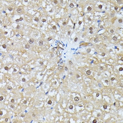 Invitrogen Ubiquitin C Polyclonal Antibody 100 &mu;L | Buy Online | Invitrogen&trade; | Fisher Scientific