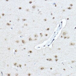 Invitrogen TWIST1 Polyclonal Antibody 100 &mu;L; Unconjugated:Antibodies,