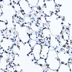 Invitrogen TWIST1 Polyclonal Antibody 100 &mu;L; Unconjugated:Antibodies,