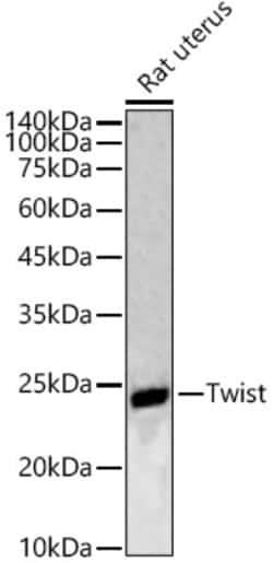 Invitrogen TWIST1 Polyclonal Antibody 100 &mu;L; Unconjugated:Antibodies,