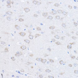 Invitrogen UBE4A Polyclonal Antibody 100 &mu;L; Unconjugated:Antibodies,