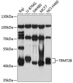 Invitrogen TRMT2B Polyclonal Antibody 100 &mu;L; Unconjugated:Antibodies,