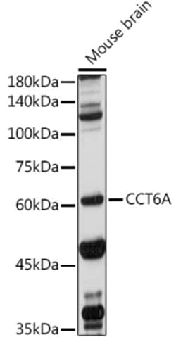 Invitrogen TCP-1 zeta Polyclonal Antibody 100 &mu;L; Unconjugated:Antibodies,