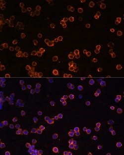 Invitrogen CD39 Polyclonal Antibody 100 &mu;L; Unconjugated:Antibodies,