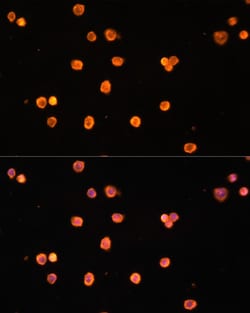 Invitrogen CD39 Polyclonal Antibody 100 &mu;L; Unconjugated:Antibodies,