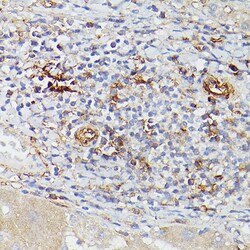 Invitrogen CD39 Polyclonal Antibody 100 &mu;L; Unconjugated:Antibodies,