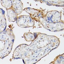 Invitrogen CD39 Polyclonal Antibody 100 &mu;L; Unconjugated:Antibodies,