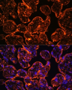 Invitrogen CD39 Polyclonal Antibody 100 &mu;L; Unconjugated:Antibodies,
